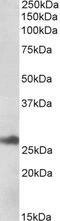 Isocitrate dehydrogenase [NAD] subunit gamma, mitochondrial antibody, 42-379, ProSci, Enzyme Linked Immunosorbent Assay image 