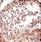 Tankyrase-1 antibody, LS-C160090, Lifespan Biosciences, Immunohistochemistry paraffin image 