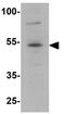 HNF-3A antibody, GTX31874, GeneTex, Western Blot image 