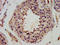 Developmental pluripotency-associated protein 3 antibody, LS-C674364, Lifespan Biosciences, Immunohistochemistry paraffin image 