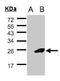 Ubiquitin Conjugating Enzyme E2 F (Putative) antibody, NBP2-19292, Novus Biologicals, Western Blot image 