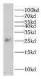 Probable RNA-binding protein EIF1AD antibody, FNab02684, FineTest, Western Blot image 