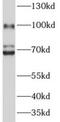 Disintegrin and metalloproteinase domain-containing protein 2 antibody, FNab00141, FineTest, Western Blot image 