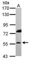 E3 ubiquitin-protein ligase RNF8 antibody, GTX115176, GeneTex, Western Blot image 