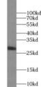 Secreted And Transmembrane 1 antibody, FNab07701, FineTest, Western Blot image 
