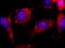 Integrin-linked protein kinase antibody, IHC-00361, Bethyl Labs, Immunofluorescence image 