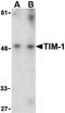 KIM-1 antibody, PA5-20245, Invitrogen Antibodies, Western Blot image 
