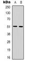B1AR antibody, LS-C368864, Lifespan Biosciences, Western Blot image 