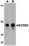 Secernin 2 antibody, A15761, Boster Biological Technology, Western Blot image 