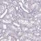 Desmocollin 3 antibody, HPA049265, Atlas Antibodies, Immunohistochemistry frozen image 