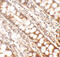 Periphilin 1 antibody, 6687, ProSci Inc, Immunohistochemistry paraffin image 