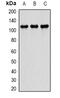 cAMP-specific 3 ,5 -cyclic phosphodiesterase 4D antibody, abx142132, Abbexa, Western Blot image 