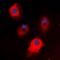 STEAP3 Metalloreductase antibody, orb304610, Biorbyt, Immunocytochemistry image 
