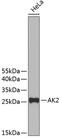 Adenylate kinase 2, mitochondrial antibody, 19-133, ProSci, Western Blot image 