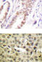 Androgen Receptor antibody, AP01524PU-N, Origene, Immunohistochemistry paraffin image 