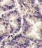 Vascular Endothelial Growth Factor C antibody, PA5-11908, Invitrogen Antibodies, Immunohistochemistry paraffin image 