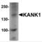 Hedgehog Acyltransferase Like antibody, NBP2-81952, Novus Biologicals, Western Blot image 