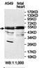 Zinc Finger Protein 561 antibody, orb78221, Biorbyt, Western Blot image 