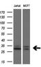 Homeobox protein TGIF1 antibody, M04122, Boster Biological Technology, Western Blot image 