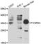 CD32a antibody, LS-C331441, Lifespan Biosciences, Western Blot image 