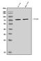 Proprotein Convertase Subtilisin/Kexin Type 9 antibody, A00085-2, Boster Biological Technology, Western Blot image 