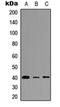 C-type lectin domain family 6 member A antibody, orb234821, Biorbyt, Western Blot image 