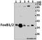 Forkhead box protein B1 antibody, A12863, Boster Biological Technology, Western Blot image 