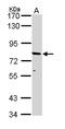 ATP Binding Cassette Subfamily D Member 2 antibody, LS-C109478, Lifespan Biosciences, Western Blot image 