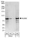 NUMB Endocytic Adaptor Protein antibody, A301-714A, Bethyl Labs, Western Blot image 