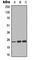 Chloride Intracellular Channel 3 antibody, abx133185, Abbexa, Western Blot image 