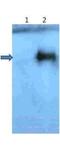 Amyloid Beta Precursor Protein antibody, NBP1-44048, Novus Biologicals, Western Blot image 