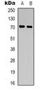 Immunoglobulin Superfamily Member 8 antibody, abx133778, Abbexa, Western Blot image 