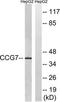 Calcium Voltage-Gated Channel Auxiliary Subunit Gamma 7 antibody, TA315693, Origene, Western Blot image 