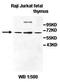 ATP Binding Cassette Subfamily D Member 4 antibody, orb77537, Biorbyt, Western Blot image 