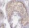 Mitochondrial Assembly Of Ribosomal Large Subunit 1 antibody, FNab01134, FineTest, Immunohistochemistry frozen image 