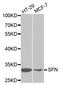 Stratifin antibody, A1026, ABclonal Technology, Western Blot image 