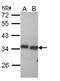 Peroxisomal trans-2-enoyl-CoA reductase antibody, NBP1-31699, Novus Biologicals, Western Blot image 