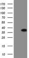 2,4-Dienoyl-CoA Reductase 1 antibody, TA808950, Origene, Western Blot image 