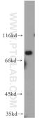 Zinc Finger DHHC-Type Containing 5 antibody, 21324-1-AP, Proteintech Group, Western Blot image 