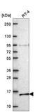 NADH:Ubiquinone Oxidoreductase Subunit A7 antibody, NBP2-57928, Novus Biologicals, Western Blot image 