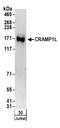 Cramped Chromatin Regulator Homolog 1 antibody, A304-094A, Bethyl Labs, Western Blot image 