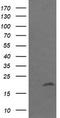 Ubiquitin-conjugating enzyme E2 G2 antibody, TA505286AM, Origene, Western Blot image 