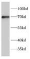Ectonucleoside Triphosphate Diphosphohydrolase 7 antibody, FNab02786, FineTest, Western Blot image 