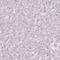 Guanylate cyclase 2G antibody, HPA036760, Atlas Antibodies, Immunohistochemistry paraffin image 