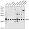 Ring Finger Protein 5 antibody, GTX33468, GeneTex, Western Blot image 