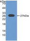 CYLD Lysine 63 Deubiquitinase antibody, MBS2028652, MyBioSource, Western Blot image 