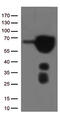 Estrogen Receptor 1 antibody, TA807239S, Origene, Western Blot image 