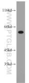 NOP58 Ribonucleoprotein antibody, 14409-1-AP, Proteintech Group, Western Blot image 