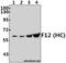 Coagulation Factor XII antibody, A01226-2, Boster Biological Technology, Western Blot image 