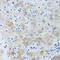 Electrogenic sodium bicarbonate cotransporter 4 antibody, 13-648, ProSci, Immunohistochemistry paraffin image 